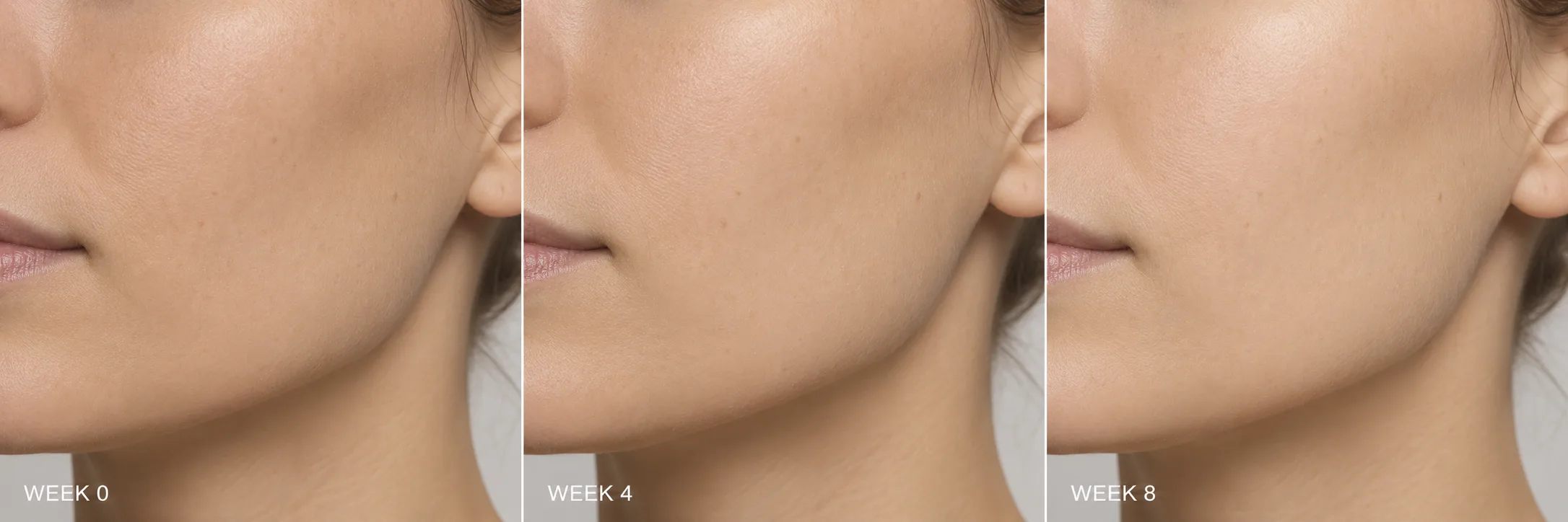 Three side-by-side portrait crops — cheekbone and jawline only — same neutral light, same head angle, labelled Week 0, Week 4, and Week 8.